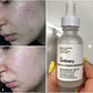 Niacinamide 10% + Zinc 1% Serum 30ml – Oil Control & Pore Refining - Smartify Zone